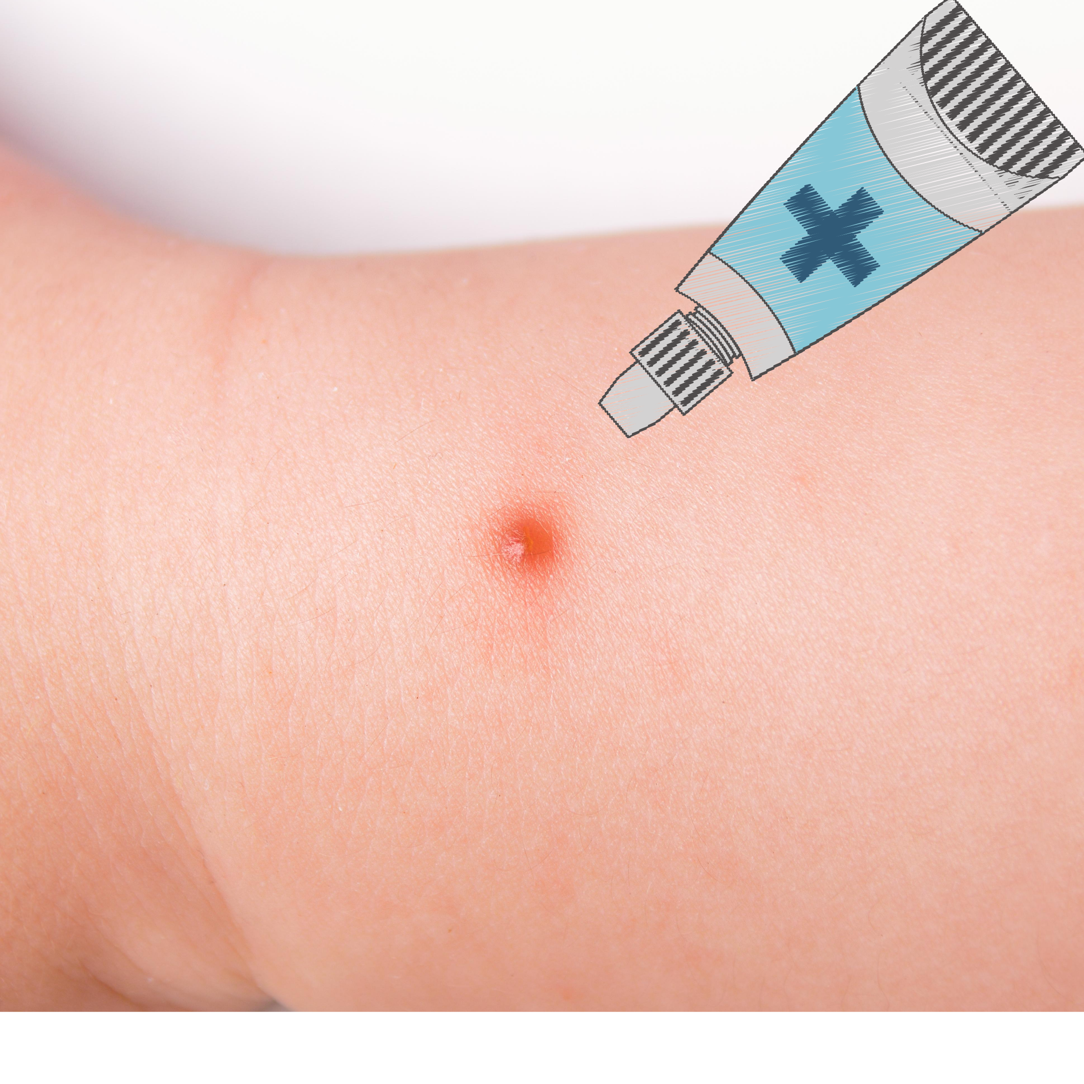 Pasta de Lassar en México Pasta de Lassar en México