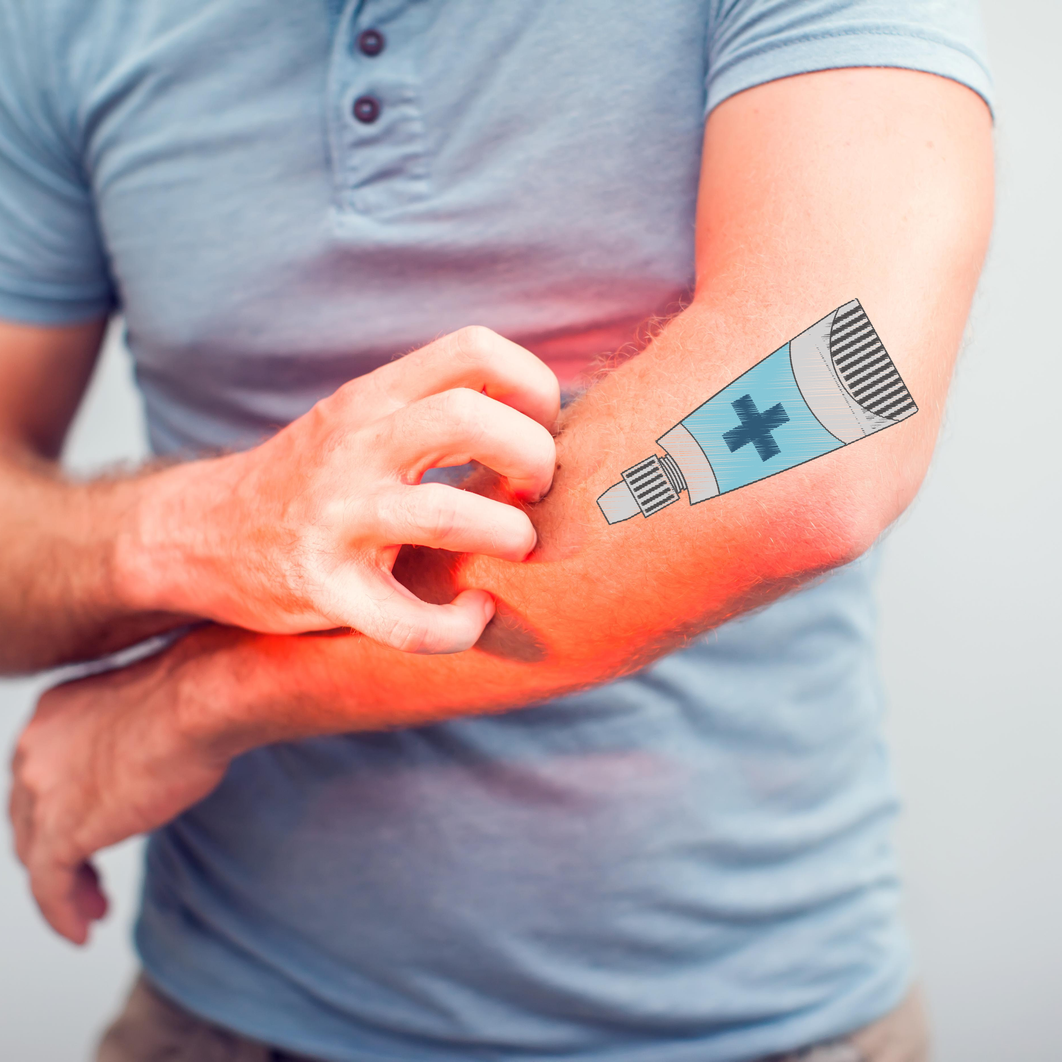 Pasta de Lassar en México Pasta de Lassar en México